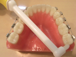 一番奥の歯の裏側の清掃